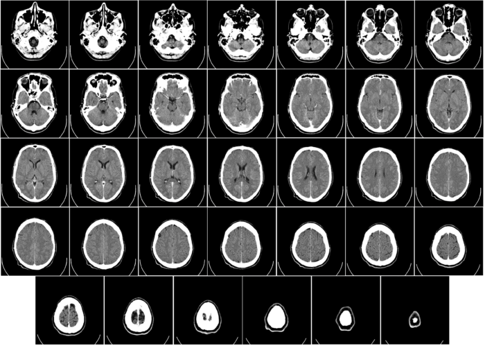 How to form and cure a headache | Nexus newspaper